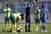 Istra s igračem više okrenula lokose, Radonjić se ozlijedio